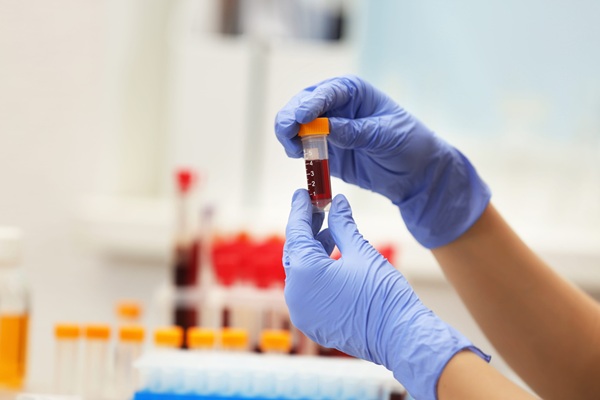 Imagen: El seguimiento de las tendencias de los análisis de sangre junto con la pérdida de peso inexplicable puede ayudar a identificar a los pacientes con mayor riesgo de cáncer y respaldar una investigación más temprana (Crédito de la imagen: 123RF)