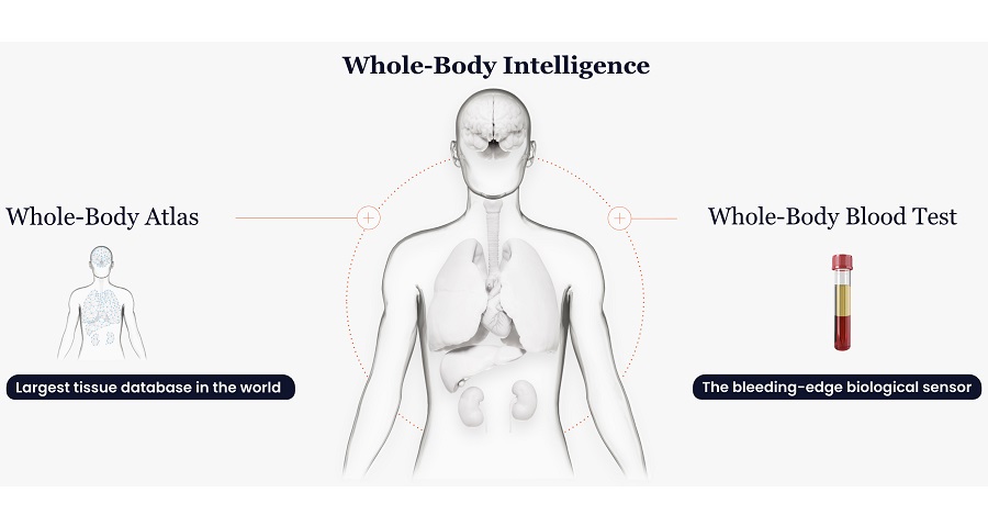 Imagen: La plataforma Whole-Body Intelligence de Curve Biosciences utiliza IA y el Whole-Body Atlas de la compañía para descubrir la biología específica de órganos a partir de la sangre (fotografía cortesía de Curve Biosciences)