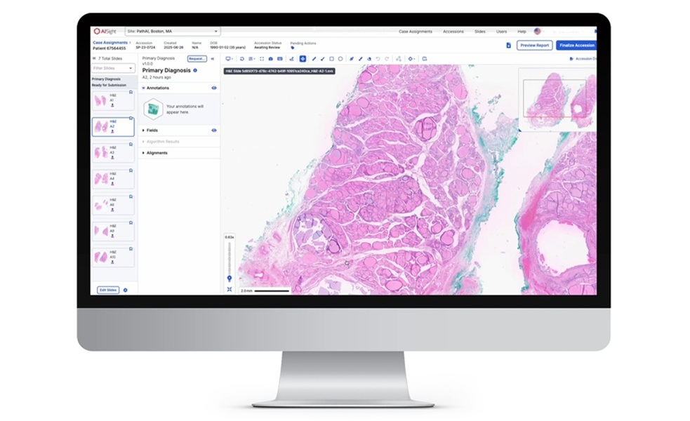 Imagen: AISight Dx es una plataforma de patología digital nativa de la nube que agiliza la gestión de casos, la revisión de diapositivas y la colaboración para mejorar los flujos de trabajo de patología anatómica (Fotografía cortesía de PathAI)