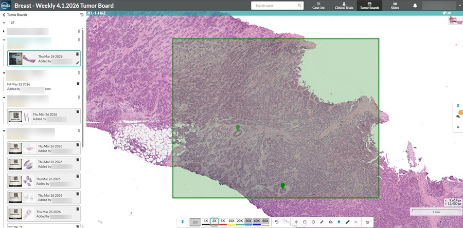Imagen: NeoGenomics seleccionó la plataforma HALO AP de Indica Labs para permitir sus operaciones de patología digital a través de un marco escalable basado en la nube (Fotografía cortesía de Indica Labs)