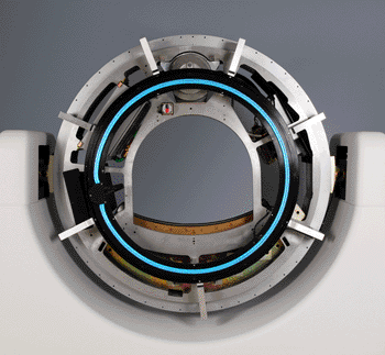 Imagen: El sistema de energía sin contacto Link transfiere energía del gantry estacionario al disco rotativo sin contactos de escobillas (Fotografía cortesía de Analogic).