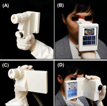 Imagen A: Diseños de estilo de empuñadura de energía (A-B) y estilo de cámara de video (C-D) del prototipo de escáner OCT. Ambos capturan imágenes OCT 3D de la retina (Fotografía cortesía de Biomedical Optics Express).
