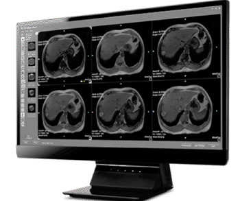 Imagen: Desarrollan software de visualización, avanzado, gratuito para datos de  tomografía computarizada (TC) y resonancia magnética (RM) (Fotografía cortesía de ORS - Object Research Systems).