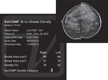 Imagen: Un pantallazo de la solución de software M-Vu Breast Density (Fotografía cortesía de VuCOMP).