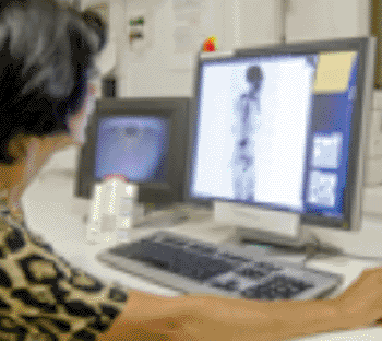 Imagen: Técnica de exploración pionera de los investigadores ICR que puede visualizar el cuerpo entero de un paciente para revelar los sitios dónde el cáncer está afectando los huesos (Fotografía cortesía del Instituto de Investigación de Cáncer- ICR).