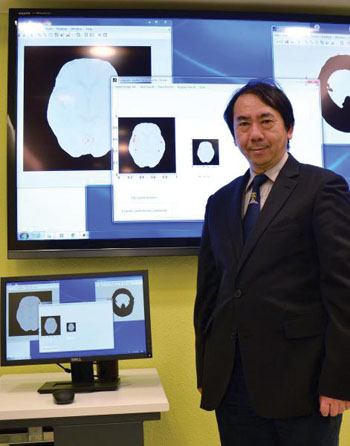 Imagen A: El Dr. Fuk-hay Tang cree que el sistema CAD para apoplejía aumenta la esperanza para los pacientes con accidente cerebrovascular isquémico mediante la detección con la tomografía computarizada (TC) de los signos de accidente cerebrovascular (Fotografía cortesía de la Universidad Politécnica de Hong Kong).