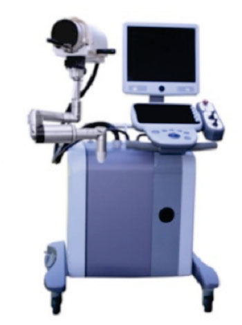 Imagen: La máquina Vortx Rx para histotripsia (Fotografía cortesía de HistoSonics).