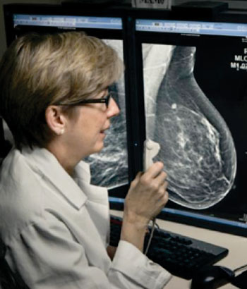 Imágenes: Los estudios demuestran que la mamografía tridimensional detecta más tumores malignos invasivos y disminuye las tasas de rellamado (Fotografía cortesía de Medicina de Penn).