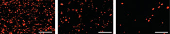 Imagen B: Microfotografías con fluorescencia que muestran unas células de cáncer de mama teñidas de rojo que fueron expuestas a tres tratamientos diferentes. El uso de ultrasonido para disparar ráfagas periódicas de dosis mayores del fármaco (derecha) fue más eficaz para destruir las células cancerosas (Fotografía cortesía del Instituto Wyss y la SEAS de Harvard).