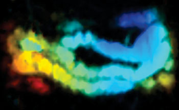 Imagen: La combinación de un nanojugo con la tomografía fotoacústica (PAT) ilumina el intestino de un ratón (Fotografía cortesía de Jonathan Lovell, Universidad de Búffalo).