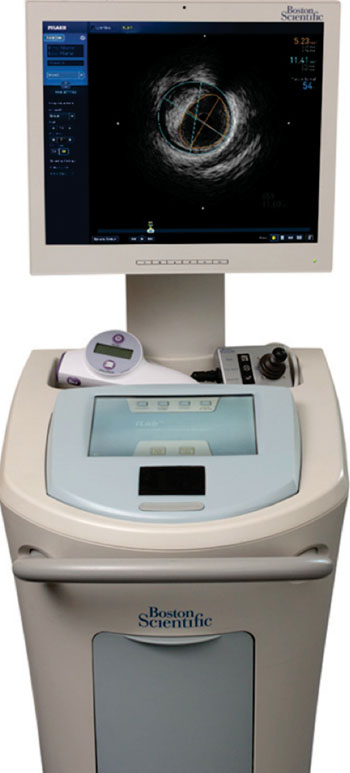 Imagen: El sistema para imágenes por ultrasonido Polaris está diseñado para obtener imágenes cardiovasculares (Fotografía cortesía de Boston Scientific).