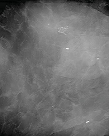 Imagen: K-vista con la tomosíntesis digital de muestras Tomospec (Fotografía cortesía de Kubtec Digital X-Ray).