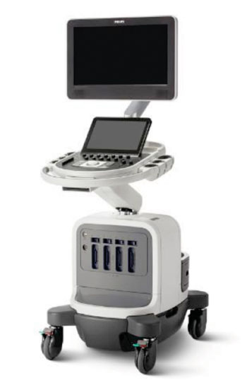 Imagen A: El sistema de ultrasonido Affiniti combina un desempeño de imagenología y un diseño ideal para un diagnóstico rápido, confiable (Fotografía cortesía de Philips Healthcare).