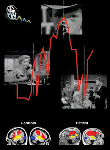 Imagen: Los pacientes en estado vegetativo tienen niveles de actividad cerebral equivalentes a los de los controles normales cuando observan una película de Alfred Hitchcock (Fotografía cortesía de Lorina Naci de la Universidad Western).