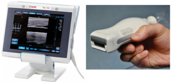 Imagen B: El sistema nuevo de imagenología consiste de una sonda manual (a la derecha) y un sistema de visualización del barrido del ultrasonido (a la izquierda). Puede ser transportado fácilmente entre las habitaciones en una clínica (Fotografía cortesía de Pim van den Berg / Khalid Daoudi).
