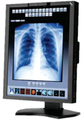 Imagen: El monitor para revisión del diagnóstico MD210C3 (Fotografía cortesía de NEC Display Solutions).