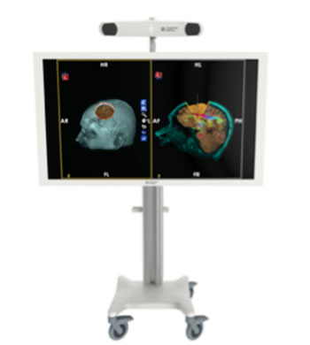 Imagen: La Guía BrightMatter, diseñada para seguir el camino de las herramientas múltiples durante un procedimiento quirúrgico en el cerebro (Fotografía cortesía de Synaptive Médica).