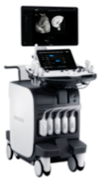 Imagen: El sistema para ultrasonido RS80A (Fotografía cortesía de Samsung Medison).