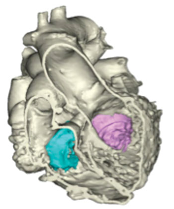 Imagen: Un modelo en 3D del corazón (Fotografía cortesía de Materialise).