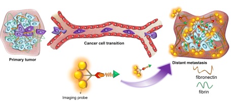 Imagen: Un agente de contraste para RM que puede unirse a los complejos de fibrina-fibronectina en los casos de cáncer agresivo de mama (Fotografía cortesía de Nature Communications y la CWRU).