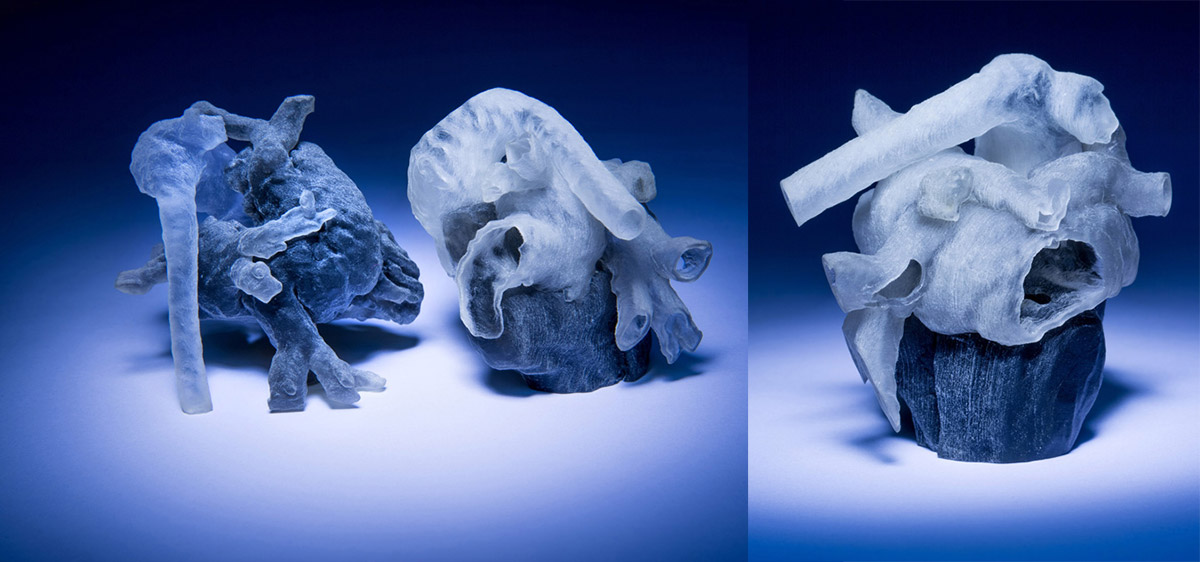 Imagen: Un nuevo sistema puede convertir las imágenes obtenidas por resonancia magnética en un modelo del corazón impreso en 3D, en el lapso de unas cuantas horas (Fotografía cortesía de Bryce Vickmark, MIT News).