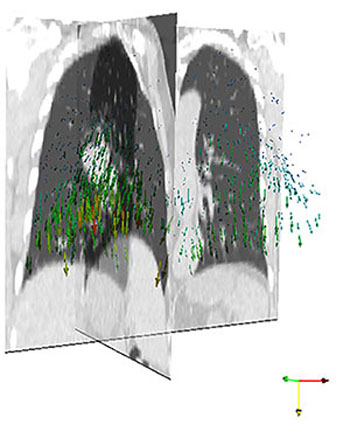 Imagen: Una representación de los pulmones obtenida mediante el método híbrido con el movimiento indicado por las flechas de colores (Fotografía cortesía de ASTAR).