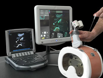 Imagen: El sistema Scenergy para la fusión de ultrasonido y de la TC (Fotografía cortesía de Clear Guide Medical).