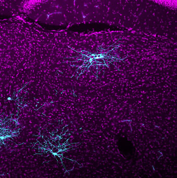Imagen: Rastreo con MRV en el tálamo de un ratón (Fotografía cortesía del Instituto Salk para Estudios Biológicos).