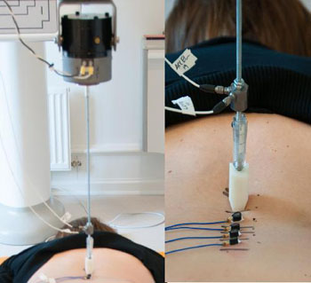 Imagen: Un ejemplo de la tecnología de vibración sísmica que se está utilizando para el diagnóstico del dolor de espalda en un paciente (Fotografía cortesía de la Universidad de Alberta).