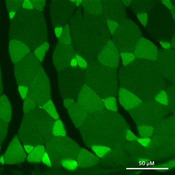 Imagen: La proteína fluorescente UnaG en las fibras musculares de las anguilas (Fotografía cortesía de RIKEN).