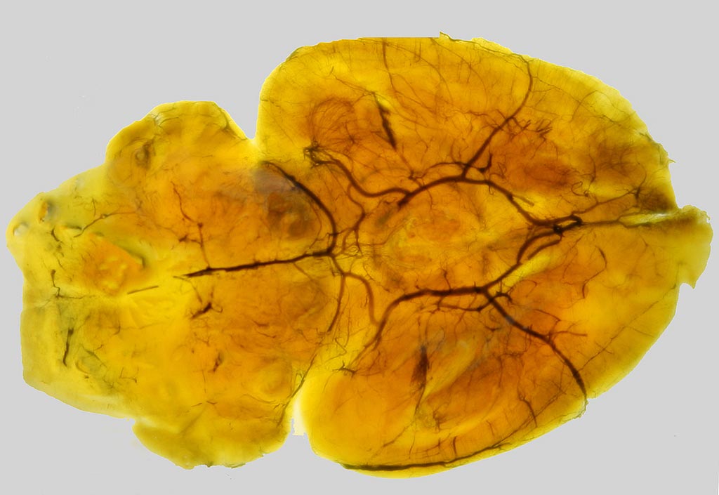 Imagen: Un cerebro de ratón impregnado con tinta china para realzar la vasculatura (Fotografía cortesía de la universidad de Surrey).