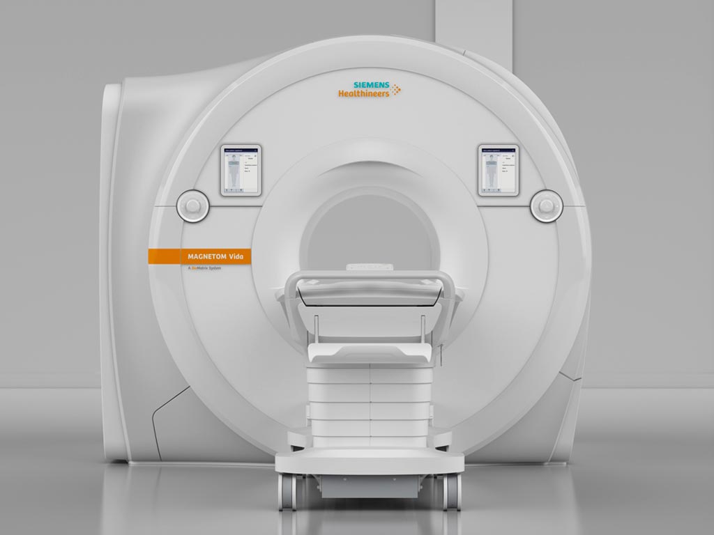 Imagen: El escáner de resonancia magnética MAGNETOM Vida (Fotografía cortesía de Siemens Healthineers).