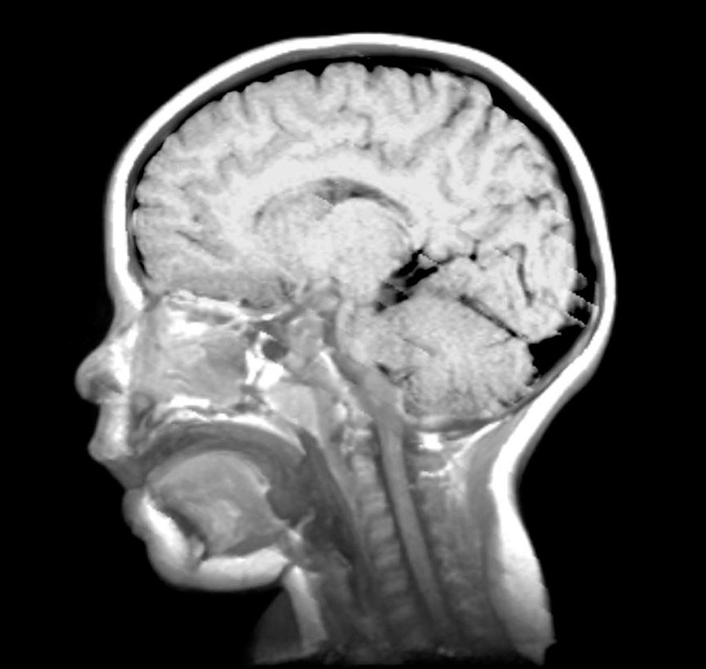 Imagen: Un examen de resonancia magnética del cerebro de un niño (Fotografía cortesía de Imagenología Médica Du Cane).