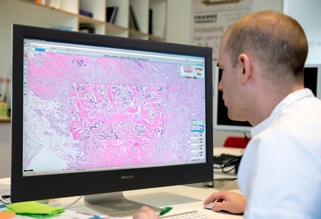 Imagen: Un patólogo que usa la nueva solución digital de patología (Fotografía cortesía de Royal Philips).