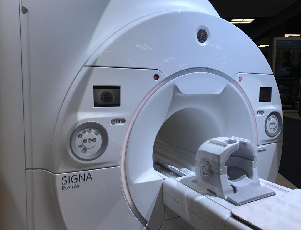 Imagen: El sistema SIGNA Premier de resonancia magnética (Fotografía cortesía de GE Healthcare).