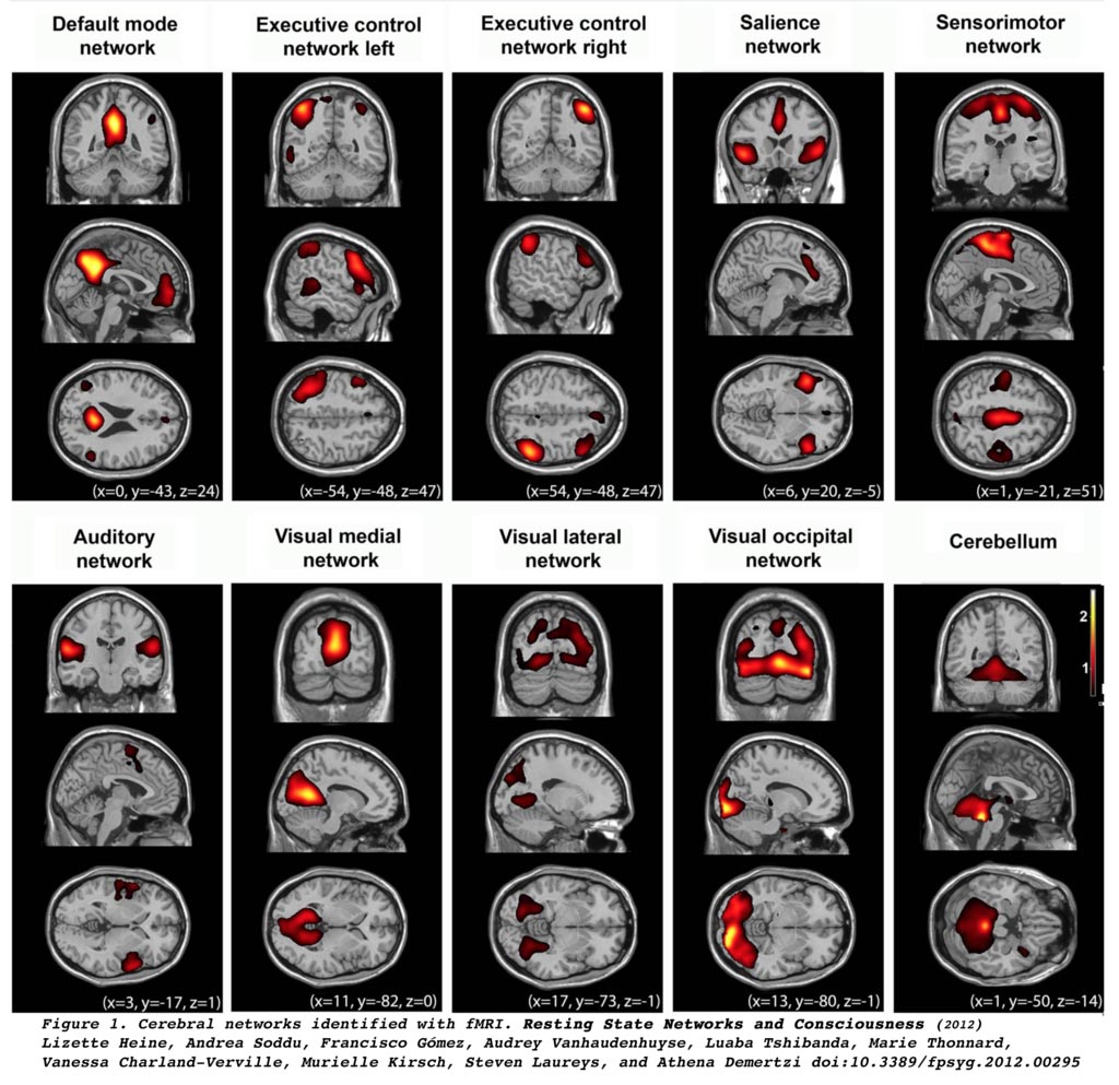 Imagen: La resonancia magnética funcional muestra 10 redes cerebrales a gran escala (Fotografía cortesía de Wikimedia).