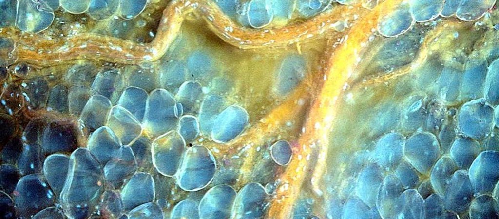 Imagen: Tejido mamario con un nervio que pasa a través de las células de grasa intactas (Fotografía cortesía de Richard Levenson / UCD).