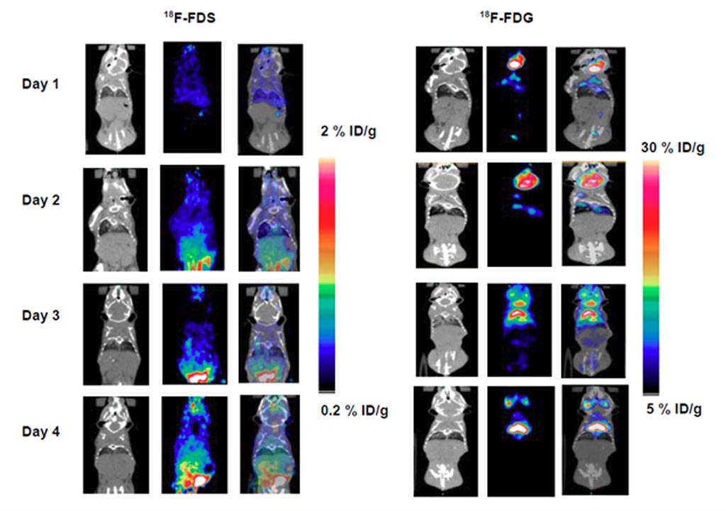 Imagen: Imágenes TEP/TC de 18F-FDS y 18F-FDG en ratones inflamados (Fotografía cortesía de J Li et al/UL).