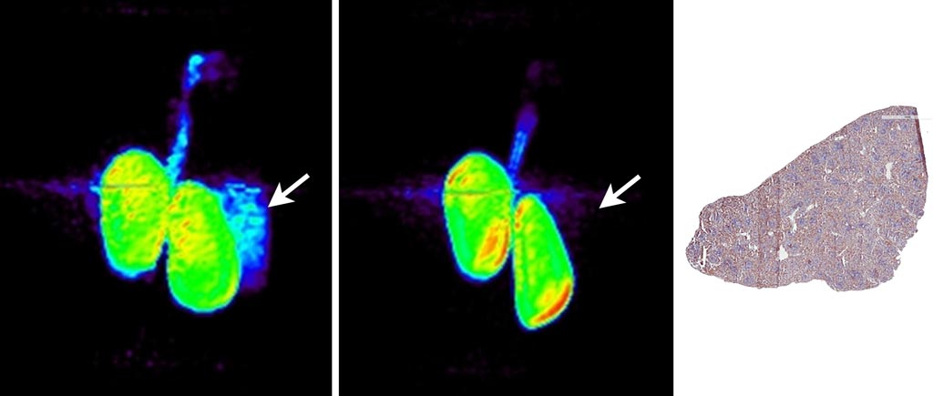 Imagen: PET de los riñones y el bazo 90 minutos después de la inyección de 18F-BMS-986192 y de la inmunohistoquímica anti-PD-L1 del tejido sano del bazo de un mono (R) (Fotografía cortesía de David Donnelly/BMS).