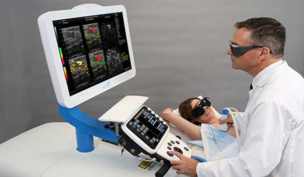 Imagen: Un novedoso sistema de imagenología mamaria fusiona la optoacústica y el ultrasonido (Fotografía cortesía de Seno Medical).