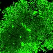 Imagen: Bacilos de tuberculosis vivos que brillan bajo la sonda fluorescente (Fotografía cortesía de Jianghong Rao/Universidad de Stanford).
