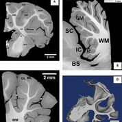Imagen: Los cortes de tejido cerebral de cordero muestran una diferencia entre la materia blanca y la gris (Fotografía cortesía de Belén Notario/CENIEH).