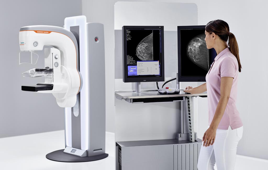 Imagen: el sistema de mamografía Mammomat Revelation (Fotografía cortesía de Siemens Healthineers).