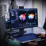 Imagen: El AcQMap crea un modelo de 360 grados de la aurícula completa (Fotografía cortesía de Acutus Medical).