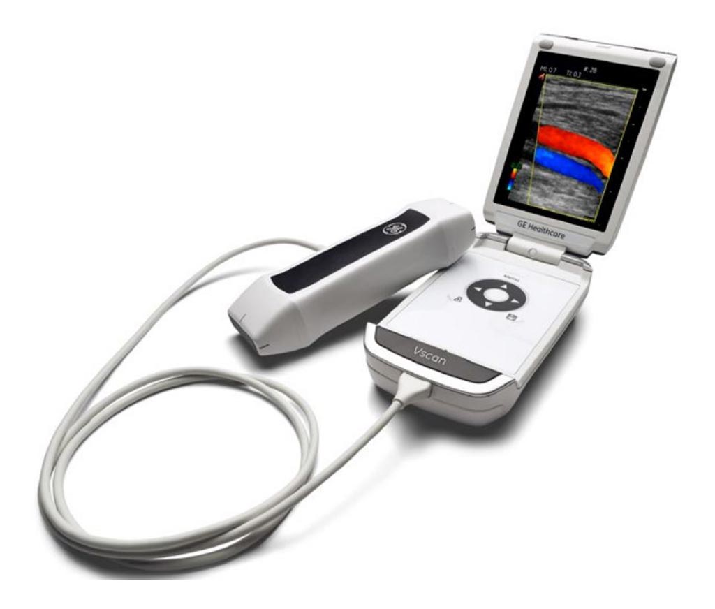 Imagen: El escáner de ultrasonido portátil, Vscan (Fotografía cortesía de GE Healthcare).