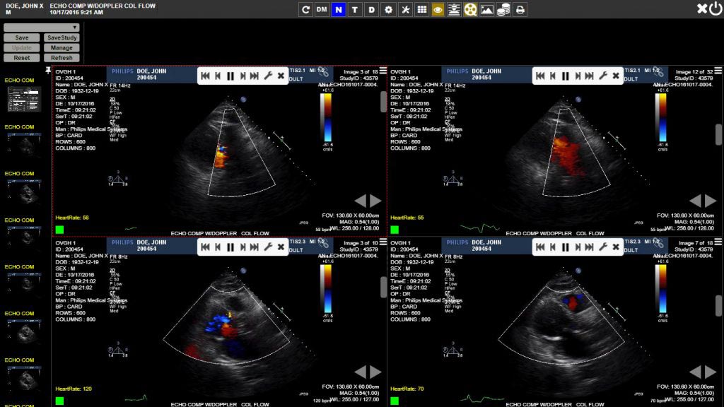 Imagen: Una instantánea de la plataforma Exa Cardio PACS (Fotografía cortesía de Konica Minolta Healthcare).