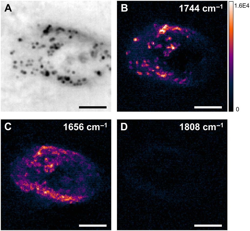 Imagen: Imagen WPS de una célula de cáncer de ovario (a), lípidos (b), proteínas (c) y fuera de resonancia (d) respectivamente (Fotografía cortesía de Ji-Xin Cheng et al).