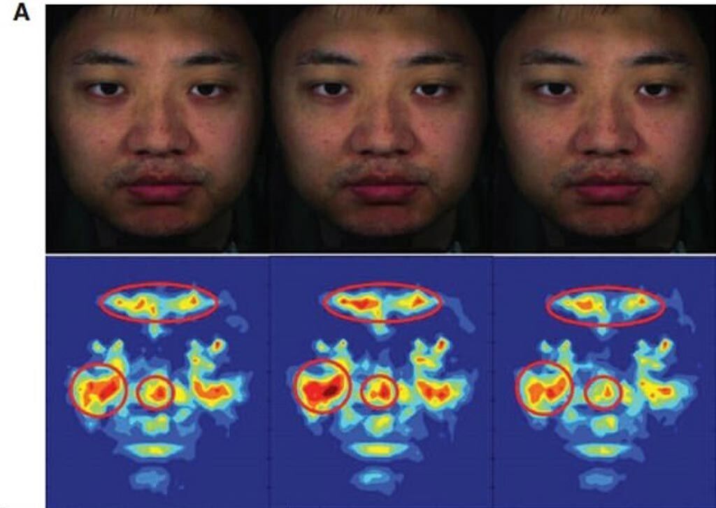 Imagen: Un estudio nuevo afirma que se pueden usar áreas específicas del rostro humano para medir ópticamente la PA (Fotografía cortesía de Kang Lee/UT).