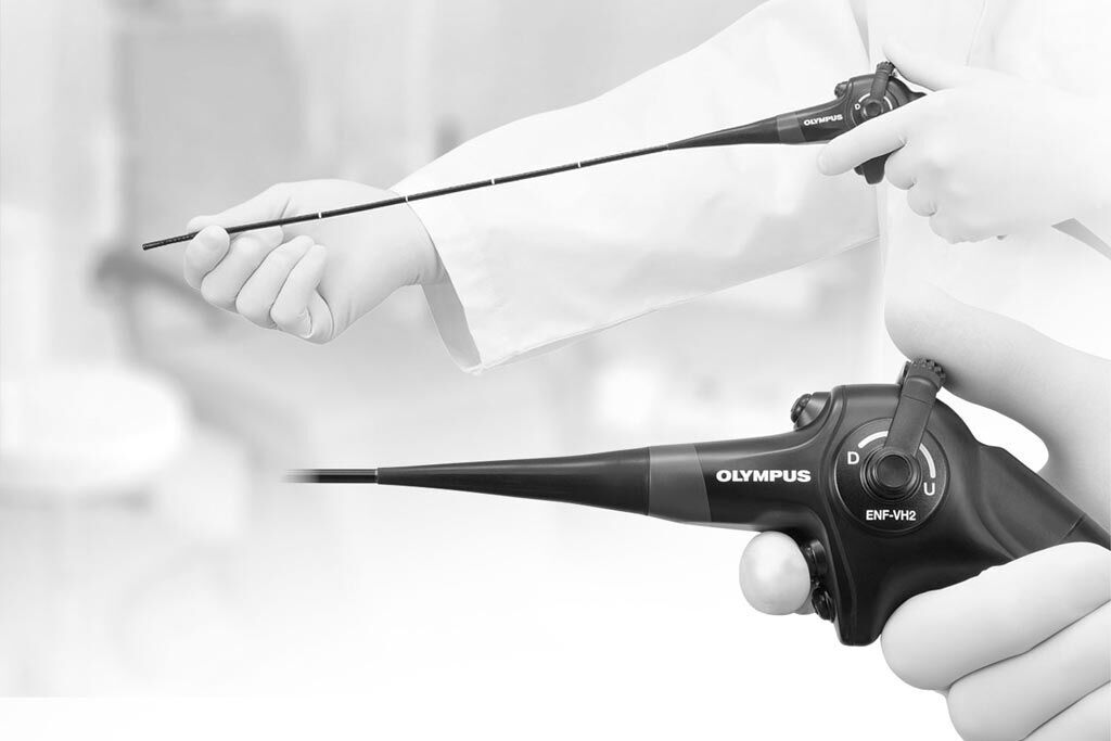 Imagen: El rinolaringoscopio con video ENF-VH2 (Fotografía cortesía de Olympus Medical).