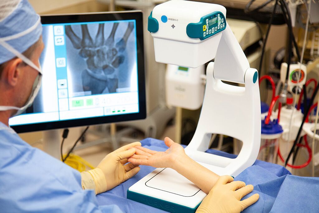Imagen: El dispositivo portátil de imágenes de rayos X Smart con brazo en C (Fotografía cortesía de Turner Imaging Systems)